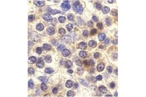 Image no. 1 for anti-Chemokine (C-X3-C Motif) Receptor 1 (CX3CR1) antibody (ABIN203578) (CX3CR1 抗体)