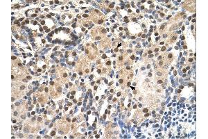ANP32E antibody was used for immunohistochemistry at a concentration of 4-8 ug/ml. (ANP32E 抗体)