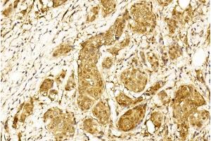Immunohistochemistry (IHC) image for anti-Signal Transducer and Activator of Transcription 3 (Acute-Phase Response Factor) (STAT3) antibody (ABIN1944789)