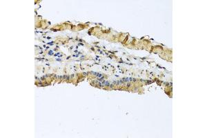 Immunohistochemistry of paraffin-embedded mouse lung using ATP2C1 antibody.