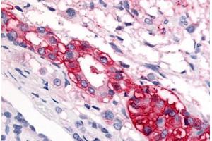 Immunohistochemistry (IHC) image for anti-Corticotropin Releasing Hormone Receptor 1 (CRHR1) (Extracellular Domain) antibody (ABIN1048462)