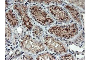 Immunohistochemical staining of paraffin-embedded Human Kidney tissue using anti-RFXANK mouse monoclonal antibody. (RFXANK 抗体)