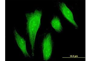Immunofluorescence of monoclonal antibody to DAXX on HeLa cell.