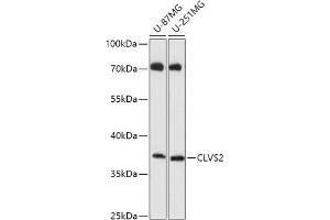 Western blot analysis of extracts of various cell lines, using CLVS2 antibody (ABIN7266410) at 1:1000 dilution. (CLVS2 抗体  (AA 265-327))