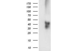 Western Blotting (WB) image for anti-Transmembrane Protein with EGF-Like and Two Follistatin-Like Domains 2 (TMEFF2) antibody (ABIN1501418) (TMEFF2 抗体)