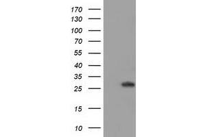 Western Blotting (WB) image for anti-Bridging Integrator 3 (BIN3) antibody (ABIN1496923) (BIN3 抗体)
