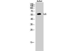 Western Blotting (WB) image for anti-Lymphocyte-Specific Protein tyrosine Kinase (LCK) (Ser736) antibody (ABIN3185366)