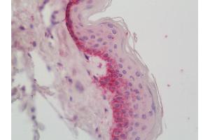 Immunohistochemistry (Paraffin-embedded Sections) (IHC (p)) image for anti-Collagen, Type XVII, alpha 1 (COL17A1) antibody (Biotin) (ABIN2595787)