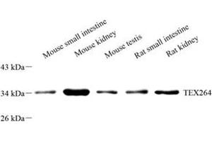 Western blot analysis of TEX264 (ABIN7075863) at dilution of 1: 2000 (TEX264 抗体)