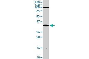 DLX3 MaxPab rabbit polyclonal antibody. (DLX3 抗体  (AA 1-287))