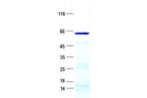 Western Blotting (WB) image for Syntaxin 11 (STX11) protein (GST tag,His tag) (ABIN5505780)