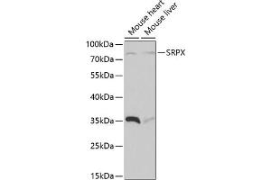 Western blot analysis of extracts of various cell lines, using SRPX antibody  at 1:1000 dilution. (SRPX 抗体  (AA 40-320))