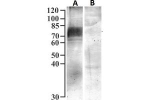 Western Blotting (WB) image for anti-Solute Carrier Family 5 (Sodium/glucose Cotransporter), Member 1 (SLC5A1) (Internal Region) antibody (ABIN7013885)