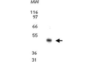 Western blot analysis for CCR10. (CCR10 抗体  (AA 350-362))