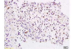 Formalin-fixed and paraffin embedded rat colon labeled with Anti-FOXJ1/HFH-4 Polyclonal Antibody, Unconjugated (ABIN734288) at 1:200 followed by conjugation to the secondary antibody and DAB staining.