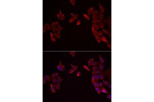 Immunofluorescence analysis of MCF-7 cell using RAMP3 antibody. (RAMP3 抗体)