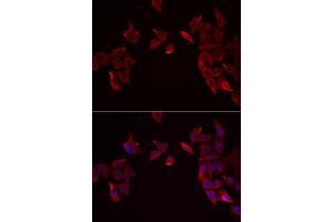 Immunofluorescence analysis of MCF-7 cell using RAMP3 antibody. (RAMP3 抗体)