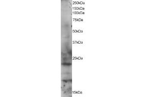 ABIN184568 staining (1µg/ml) of HeLa lysate (RIPA buffer, 35µg total protein per lane). (RAB2A 抗体  (C-Term))