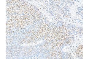 Immunohistochemistry (IHC) image for anti-RNA Binding Motif Protein 9 (RBM9) (AA 1-50) antibody (ABIN7454680) (RBM9 抗体  (AA 1-50))