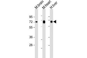 All lanes : Anti-PGM1 Antibody (C-Term) at 1:2000 dilution Lane 1: mouse brain lysates Lane 2: mouse heart lysates Lane 3: human liver lysates Lysates/proteins at 20 μg per lane.