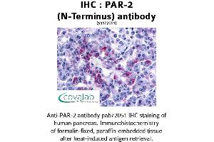 Image no. 1 for anti-Nuclear Receptor Subfamily 1, Group I, Member 2 (NR1I2) (Extracellular Domain), (N-Term) antibody (ABIN1737851)
