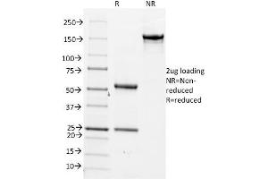 SDS-PAGE Analysis Purified CDC20 Mouse Monoclonal Antibody (AR12). (CDC20 抗体)