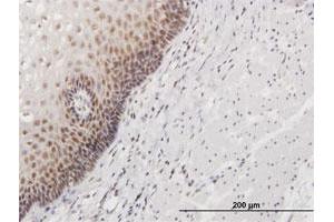 Immunohistochemistry (Formalin-fixed Paraffin-embedded Sections) (IHC (fp)) image for anti-Nucleolar Protein 16 (NOP16) (AA 1-178) antibody (ABIN526755)
