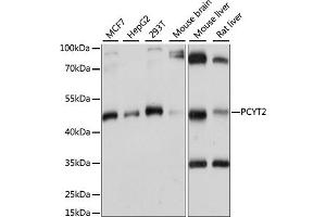 Western blot analysis of extracts of various cell lines, using PCYT2 antibody (ABIN7269277) at 1:1000 dilution. (PCYT2 抗体  (AA 1-389))