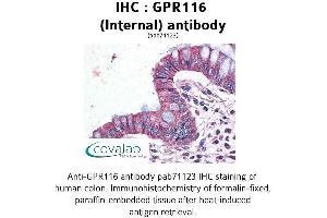 Image no. 1 for anti-G Protein-Coupled Receptor 116 (GPR116) (Internal Region) antibody (ABIN1734909) (G Protein-Coupled Receptor 116 抗体  (Internal Region))