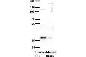 WB Suggested Anti-C21orf59 Antibody Titration:  5% Milk  ELISA Titer:  dilution: 1:500  Positive Control:  human LCL and mouse brains (C21orf59 抗体  (N-Term))