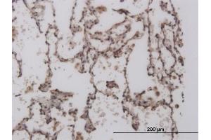 Immunoperoxidase of monoclonal antibody to FOXL1 on formalin-fixed paraffin-embedded human lung. (FOXL1 抗体  (AA 132-240))