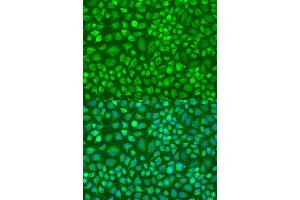 Immunofluorescence analysis of U2OS cells using DN antibody (ABIN6127820, ABIN6139729, ABIN6139731 and ABIN6224283) at dilution of 1:100. (DNAL1 抗体  (AA 41-190))