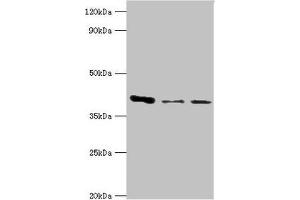 Western blot All lanes: E3 Ribonucleoside-diphosphate reductase subunit M2 B antibody at 6 μg/mL Lane 1: MCF-7 whole cell lysate Lane 2: Hela whole cell lysate Lane 3: HepG2 whole cell lysate Secondary Goat polyclonal to rabbit IgG at 1/10000 dilution Predicted band size: 41, 35, 16, 8, 5, 49 kDa Observed band size: 41 kDa (RRM2B 抗体  (AA 1-351))