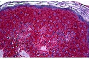 Human Skin: Formalin-Fixed, Paraffin-Embedded (FFPE) (KIT 抗体  (AA 41-140))