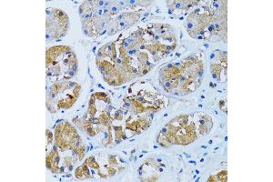 Immunohistochemistry of paraffin-embedded human stomach using IMPA1 antibody (ABIN2563424) at dilution of 1:100 (40x lens). (IMPA1 抗体)
