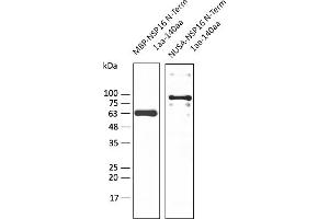Western Blotting (WB) image for anti-SARS-CoV-2 2'-O-Ribose Methyltransferase (NSP16) (N-Term) antibody (ABIN7273008) (SARS-CoV-2 NSP16 抗体  (N-Term))