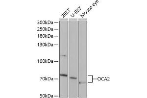 Western blot analysis of extracts of various cell lines, using OC antibody (ABIN6132880, ABIN6144989, ABIN6144990 and ABIN6221296) at 1:1000 dilution. (OCA2 抗体  (AA 1-180))