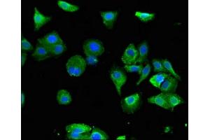Immunofluorescent analysis of HepG2 cells using ABIN7153147 at dilution of 1:100 and Alexa Fluor 488-congugated AffiniPure Goat Anti-Rabbit IgG(H+L) (FXR1 抗体  (AA 469-614))