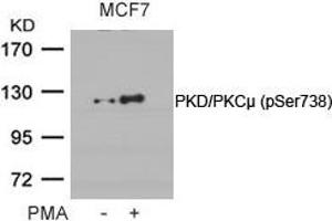 Western blot analysis of extracts from MCF cells untreated or treated with PMA using PKD/PKCm(Phospho-Ser738) Antibody. (PKC mu 抗体  (pSer738))