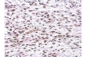 Immunohistochemistry (IHC) image for anti-Chromobox Homolog 1 (CBX1) (Center) antibody (ABIN2856369)