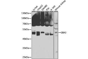 Western blot analysis of extracts of various cell lines, using GB antibody (ABIN6131369, ABIN6140990, ABIN6140991 and ABIN6223796) at 1:1000 dilution. (GBA3 抗体  (AA 1-162))