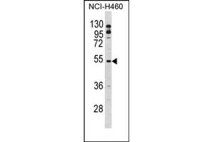 Image no. 1 for anti-B-Cell Linker (BLNK) (Middle Region) antibody (ABIN452784) (B-Cell Linker 抗体  (Middle Region))