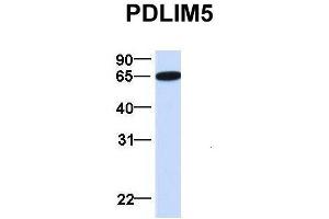 Host:  Rabbit  Target Name:  PDLIM5  Sample Type:  Human Fetal Brain  Antibody Dilution:  1. (PDLIM5 抗体  (N-Term))