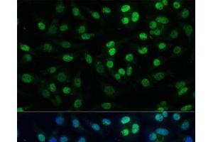 Immunofluorescence analysis of L929 cells using TRIM28 Polyclonal Antibody at dilution of 1:100 (40x lens).