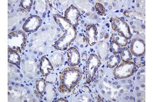 Image no. 1 for anti-Cadherin 1, Type 1, E-Cadherin (Epithelial) (CDH1) antibody (ABIN1497941) (E-cadherin 抗体)