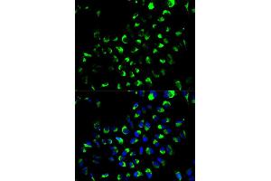 Immunofluorescence analysis of A549 cells using AK4 antibody (ABIN6290046). (AK4 抗体)