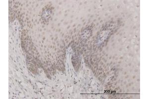 Immunoperoxidase of monoclonal antibody to SAP30 on formalin-fixed paraffin-embedded human esophagus. (SAP30 抗体  (AA 131-219))