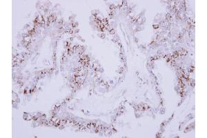 IHC-P Image Immunohistochemical analysis of paraffin-embedded OVCA xenograft, using CD75, antibody at 1:500 dilution. (ST6GAL1 抗体  (Center))