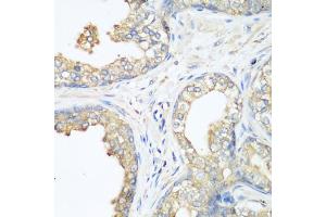 Immunohistochemistry of paraffin-embedded human prostate using CBL antibody (ABIN1871485) at dilution of 1:200 (40x lens). (CBL 抗体)