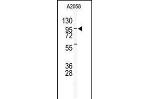 Western blot analysis of anti-USP5 Antibody in A2058 cell line lysates (35ug/lane) (USP5 抗体  (N-Term))